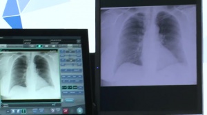 Innovation : de l’acquisition à l’impression, Konica Minolta met son expertise au service d’une gestion globale de l’imagerie médicale