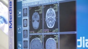 Les rencontres d'HospitaliaTV sur le congrès de l'AFIB 2023: ISIS