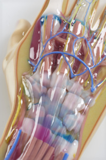 Impression 3D : Innovations médicales Impression 3D : Innovations médicales