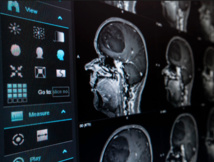 PHW 2017 : GHT et GOPI, deux Acronymes Stars du Moment (2ème partie) PHW 2017 : GHT et GOPI, deux Acronymes Stars du Moment (2ème partie)