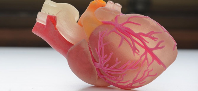 Impression 3D: Modèles pour la planification des interventions chirurgicales
