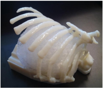 L’impression 3D en santé : c’est à Lyon que ça se passe grâce à la plateforme commune d’impression CHU de Lyon (HCL)/Université Lyon 1 L’impression 3D en santé : c’est à Lyon que ça se passe grâce à la plateforme commune d’impression CHU de Lyon (HCL)/Université Lyon 1