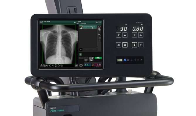 L’Ugap retient quatre solutions d’imagerie médicale mobile Fujifilm pour quatre ans