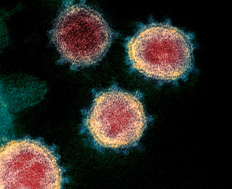 Recommandations de la Commission nationale de biologie médicale (CNBM) pour le dépistage de l’infection et de l’immunisation des patients par le SARS-CoV-2 Recommandations de la Commission nationale de biologie médicale (CNBM) pour le dépistage de l’infection et de l’immunisation des patients par le SARS-CoV-2