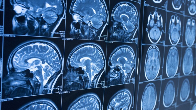 Ségur numérique : les radiologues en première ligne de la transformation de la Santé !