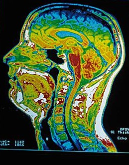 Nuance et Global Imaging On Line offrent la reconnaissance vocale dans le Cloud aux radiologues