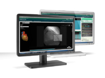 Un écran médical nettoyable pour lutter contre les infections nosocomiales Un écran médical nettoyable pour lutter contre les infections nosocomiales