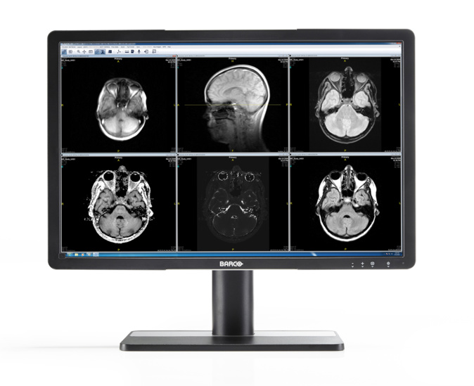 Écrans cliniques : comment la haute qualité de leurs images renforce la sécurité du patient tout en améliorant les processus cliniques