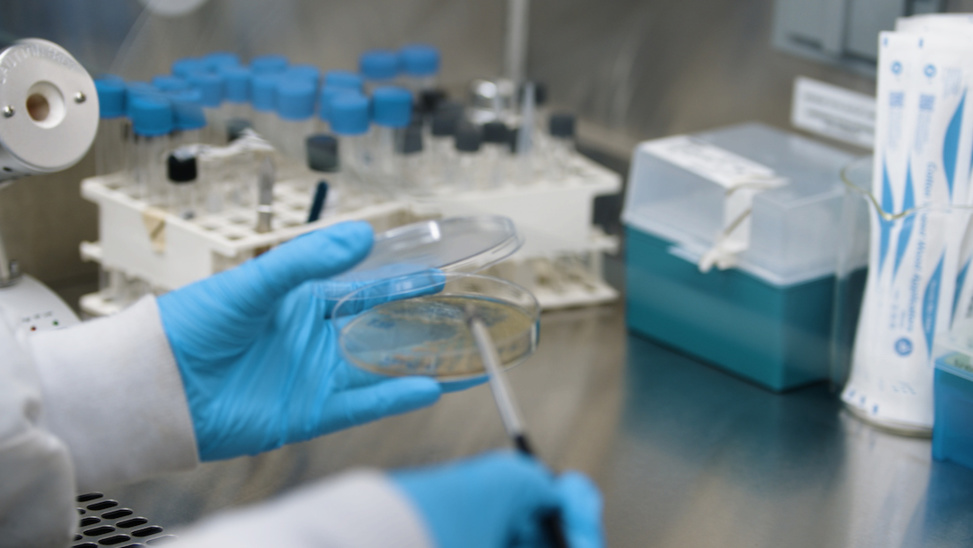 Aluminium antimicrobien autodésinfectant : la révolution A3 Surfaces Aluminium antimicrobien autodésinfectant : la révolution A3 Surfaces