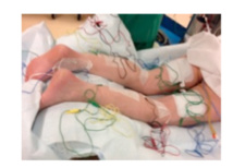 Le GH Paris Saint-Joseph crée un Centre du Rachis et se dote d’une nouvelle technique de pointe EOS pour les explorations radiologiques « corps entier » en 3D Le GH Paris Saint-Joseph crée un Centre du Rachis et se dote d’une nouvelle technique de pointe EOS pour les explorations radiologiques « corps entier » en 3D