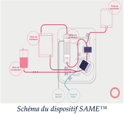 Un modèle d’évaluation des impacts budgétaires et organisationnels pour accompagner une innovation dans le Patient Blood Management Un modèle d’évaluation des impacts budgétaires et organisationnels pour accompagner une innovation dans le Patient Blood Management