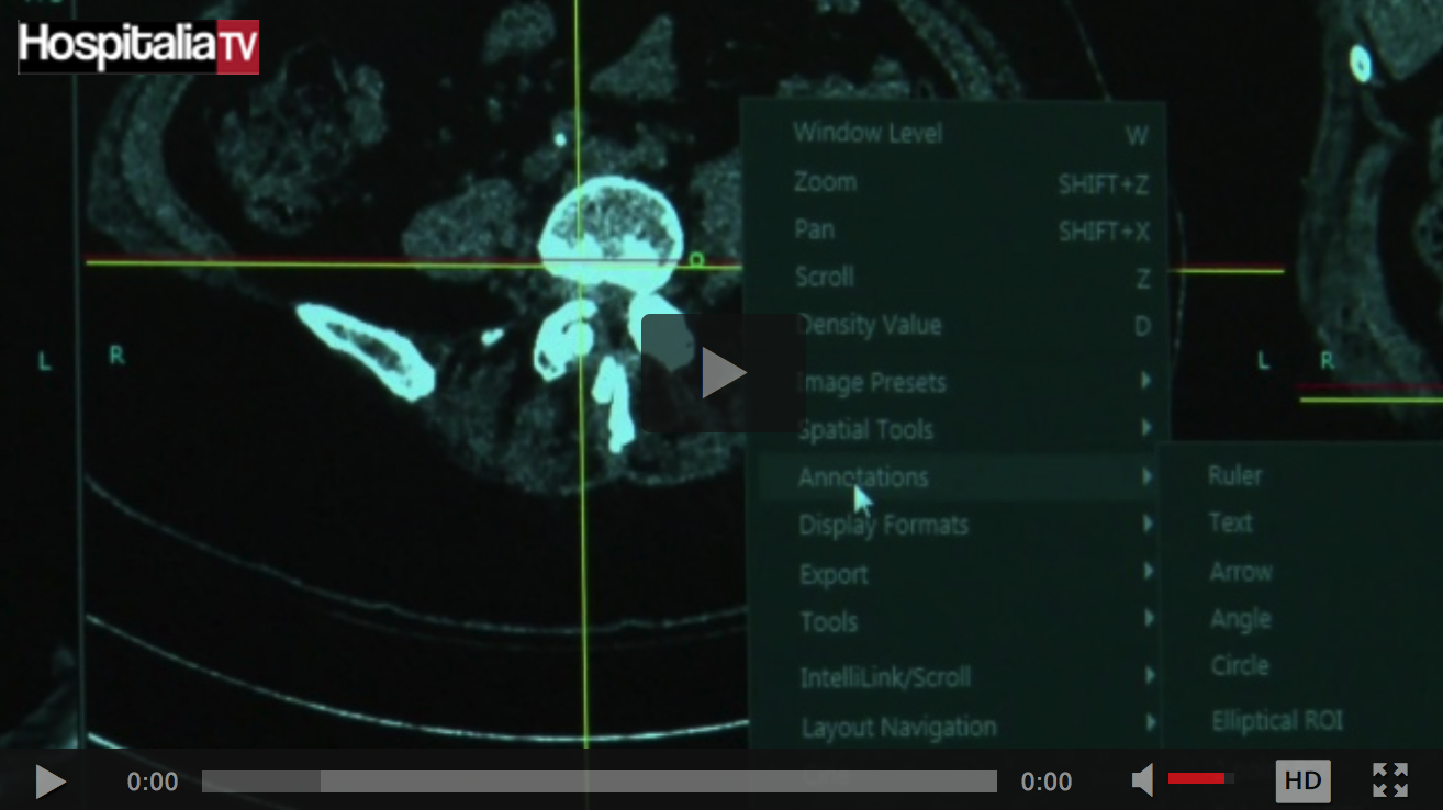 Les rencontres HospitaliaTV aux JFR 2016 : FUJIFILM MEDICAL SYSTEMS