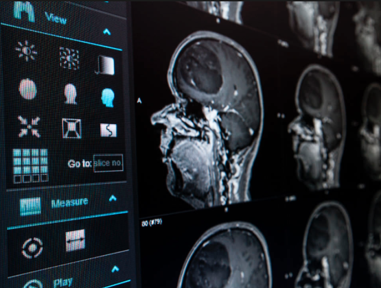PHW 2017 : GHT et GOPI, deux Acronymes Stars du Moment (2ème partie) PHW 2017 : GHT et GOPI, deux Acronymes Stars du Moment (2ème partie)