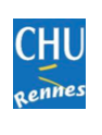 Le CHU de Rennes, 1er centre français à franchir le cap de la 100e intervention sans chirurgie sur valve mitrale