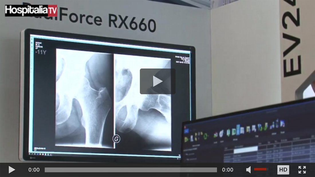 Les rencontres HospitaliaTV aux JFR 2018 : EIZO