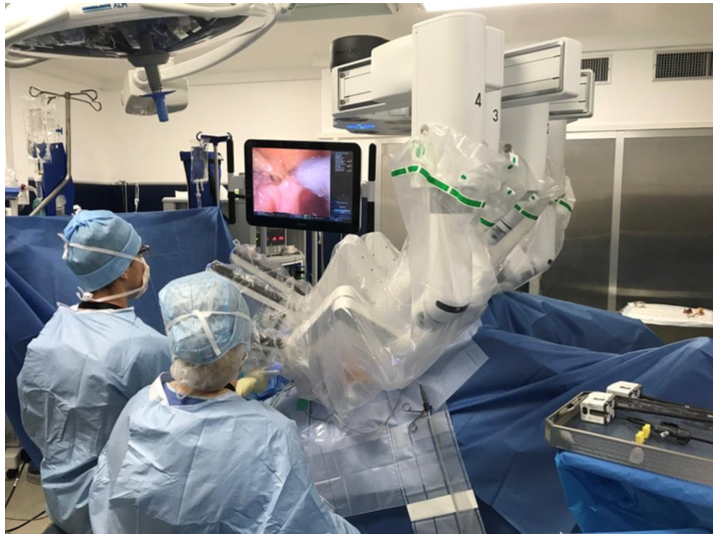 Les bras du robot chirurgical multiplient la dextérité du chirurgien
