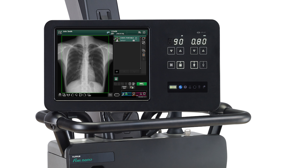 Un module d’intelligence artificielle ReiLi peut déjà être embarqué sur le mobile FDR NANO pour les examens de pneumologie, et le sera prochainement sur tous les mobiles Fujifilm. ©Fujifilm