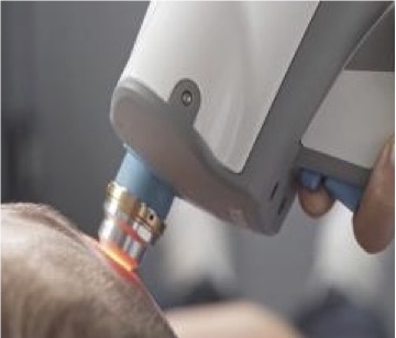 3 La line-field optical coherence tomography (LC-OCT). 3 La line-field optical coherence tomography (LC-OCT).