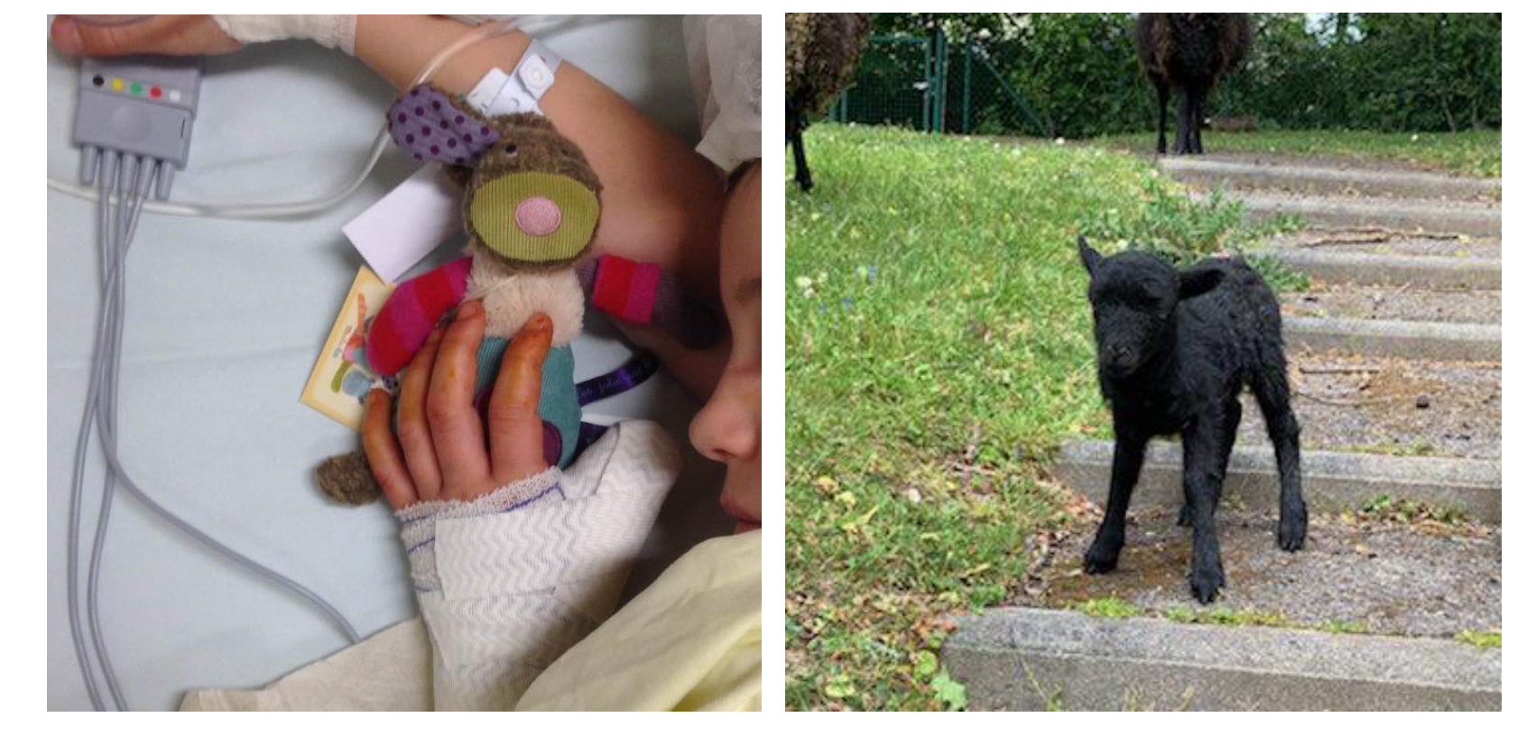 © CHU de Rennes © CHU de Rennes