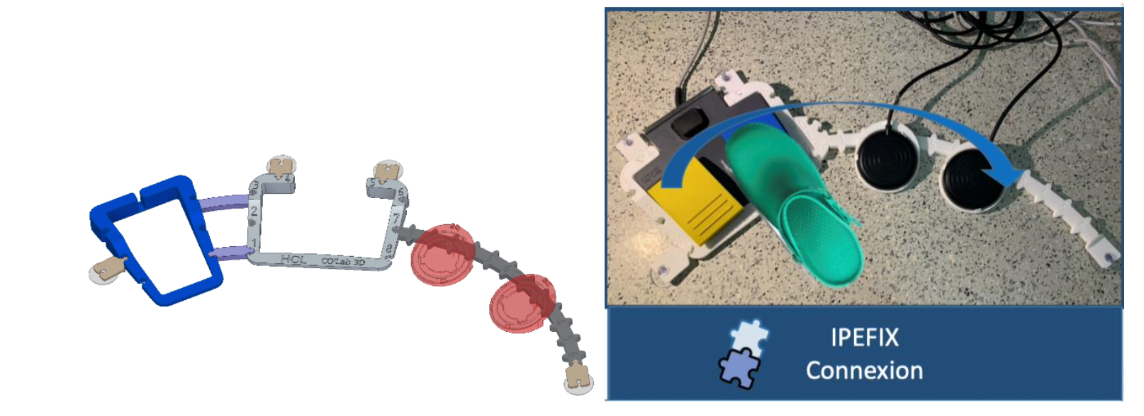 Endoscopie : les HCL lauréats du « Prix de l’innovation de l’année » grâce au fixateur de pédales imprimé en 3D