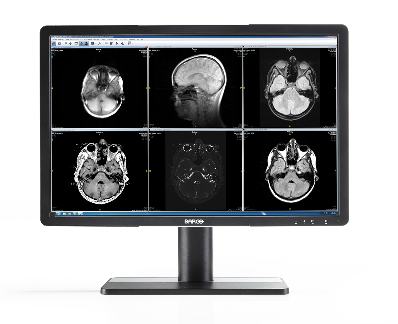 Écrans cliniques : comment la haute qualité de leurs images renforce la sécurité du patient tout en améliorant les processus cliniques