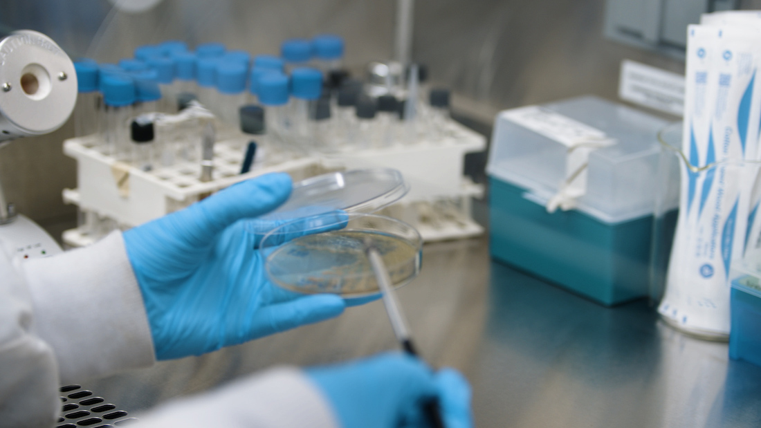 Aluminium antimicrobien autodésinfectant : la révolution A3 Surfaces