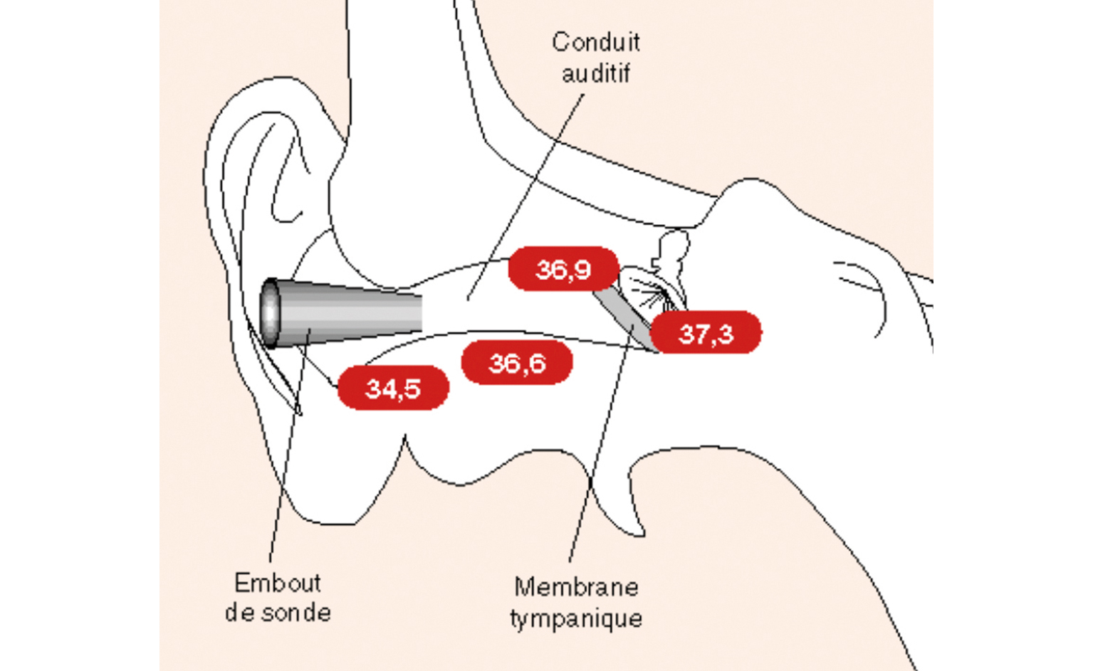 ©CHRU de Lille ©CHRU de Lille