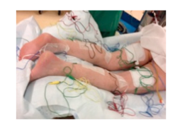 Le GH Paris Saint-Joseph crée un Centre du Rachis et se dote d’une nouvelle technique de pointe EOS pour les explorations radiologiques « corps entier » en 3D Le GH Paris Saint-Joseph crée un Centre du Rachis et se dote d’une nouvelle technique de pointe EOS pour les explorations radiologiques « corps entier » en 3D