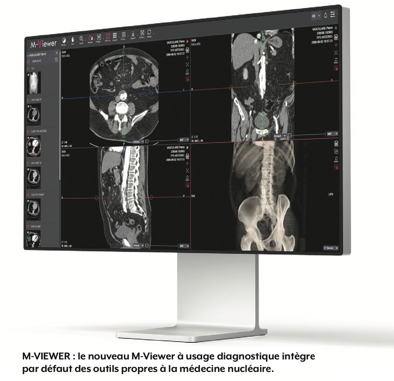 Maincare étend et muscle son offre Imagerie Médicale