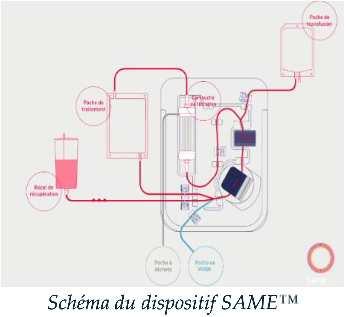Un modèle d’évaluation des impacts budgétaires et organisationnels pour accompagner une innovation dans le Patient Blood Management