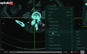 Les rencontres HospitaliaTV aux JFR 2016 : FUJIFILM MEDICAL SYSTEMS