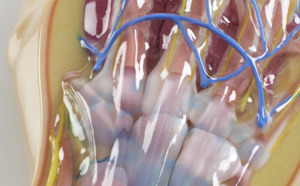 Impression 3D : Innovations médicales