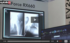 Les rencontres HospitaliaTV aux JFR 2018 : EIZO