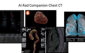 L’hôpital Foch mise sur l’intelligence artificielle