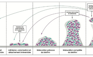 Le dioxyde de chlore, une alternative prometteuse contre les organismes multirésistants et les biofilms