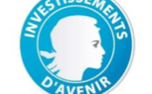 Investissements d’Avenir : 78,4 M€ pour les lauréats du deuxième appel à projets Recherche Hospitalo-Universitaire en santé