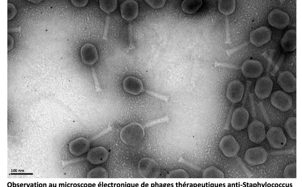 Les HCL, premier établissement public autorisé à produire des phages thérapeutiques suivant les "bonnes pratiques de fabrication"