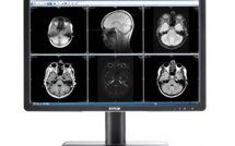 Écrans cliniques : comment la haute qualité de leurs images renforce la sécurité du patient tout en améliorant les processus cliniques