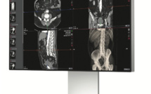 Maincare étend et muscle son offre Imagerie Médicale