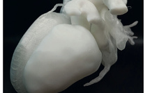 Aux HCL, l’impression 3D poursuit son développement