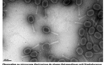 Les HCL, premier établissement public autorisé à produire des phages thérapeutiques suivant les "bonnes pratiques de fabrication"